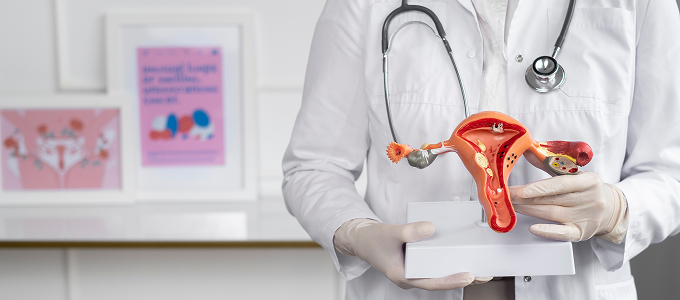 Cáncer Cervicouterino
